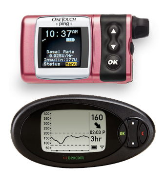 Diabetes Technology: insulin pump